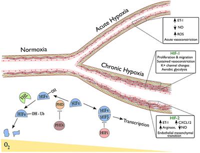 Thin Air, Thick Vessels: Historical and Current Perspectives on Hypoxic Pulmonary Hypertension